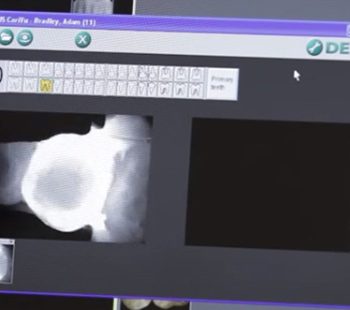 a computer screen with an x-ray on it