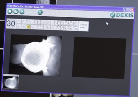 a computer screen with an x-ray on it
